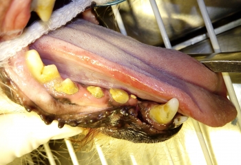 Ulcera da contatto : lesione dovuta al contatto della lingua con il tartaro 